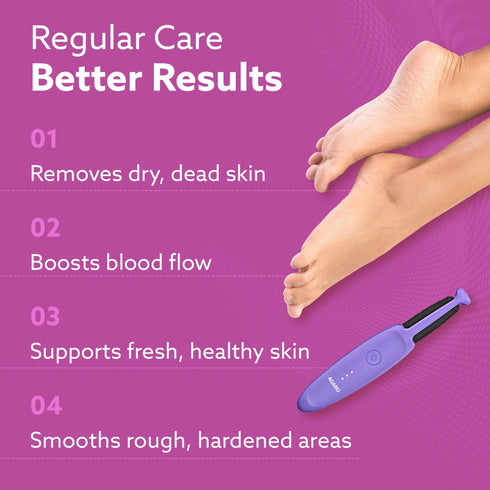 CR1414 Electric Callus Remover with 2 Replaceable Heads – Rechargeable Foot Scrubber for Dead Skin & Cracked Heels | Pedicure Machine with 120 Minutes Runtime