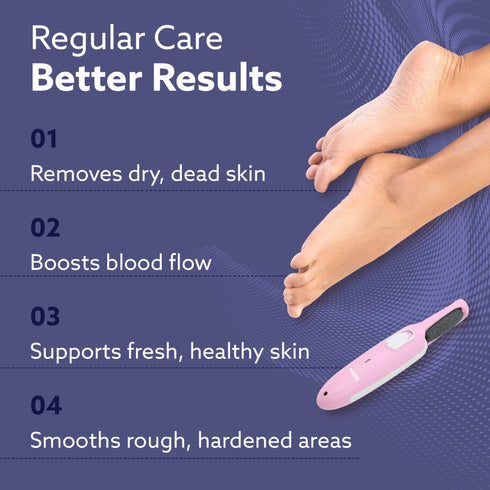 CR1717 Electric Callus Remover with 2 Replaceable Heads – Rechargeable Foot Scrubber for Dead Skin & Cracked Heels | Pedicure Machine with 120 Minutes Runtime