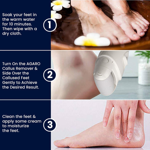 Callus Remover Replaceable heads - 3 Pcs