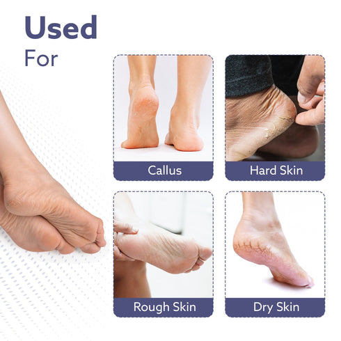 Callus Remover Replaceable Heads, 2 Pcs, Callus & Dead Skin Removal Filer, Pedicure at Home