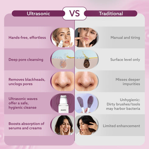 Ultrasonic Facial Skin Scrubber For Wet Skin,Blackheads Remover And Facial Pores Cleaner With 4 Modes,Stainless Steel Spatula,Rechargeable,White,Facial Cleansing Tool