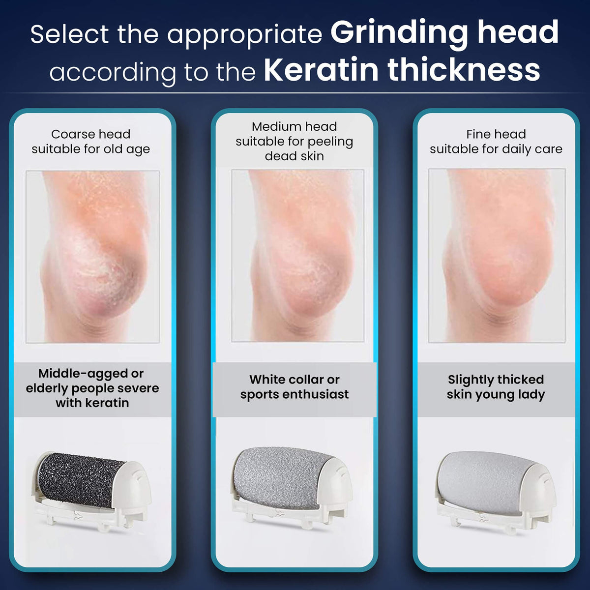 Callus Remover Replaceable heads - 3 Pcs