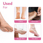 Callus Remover Replaceable Heads, 2 Pcs, Callus & Dead Skin Removal Filer, Pedicure at Home