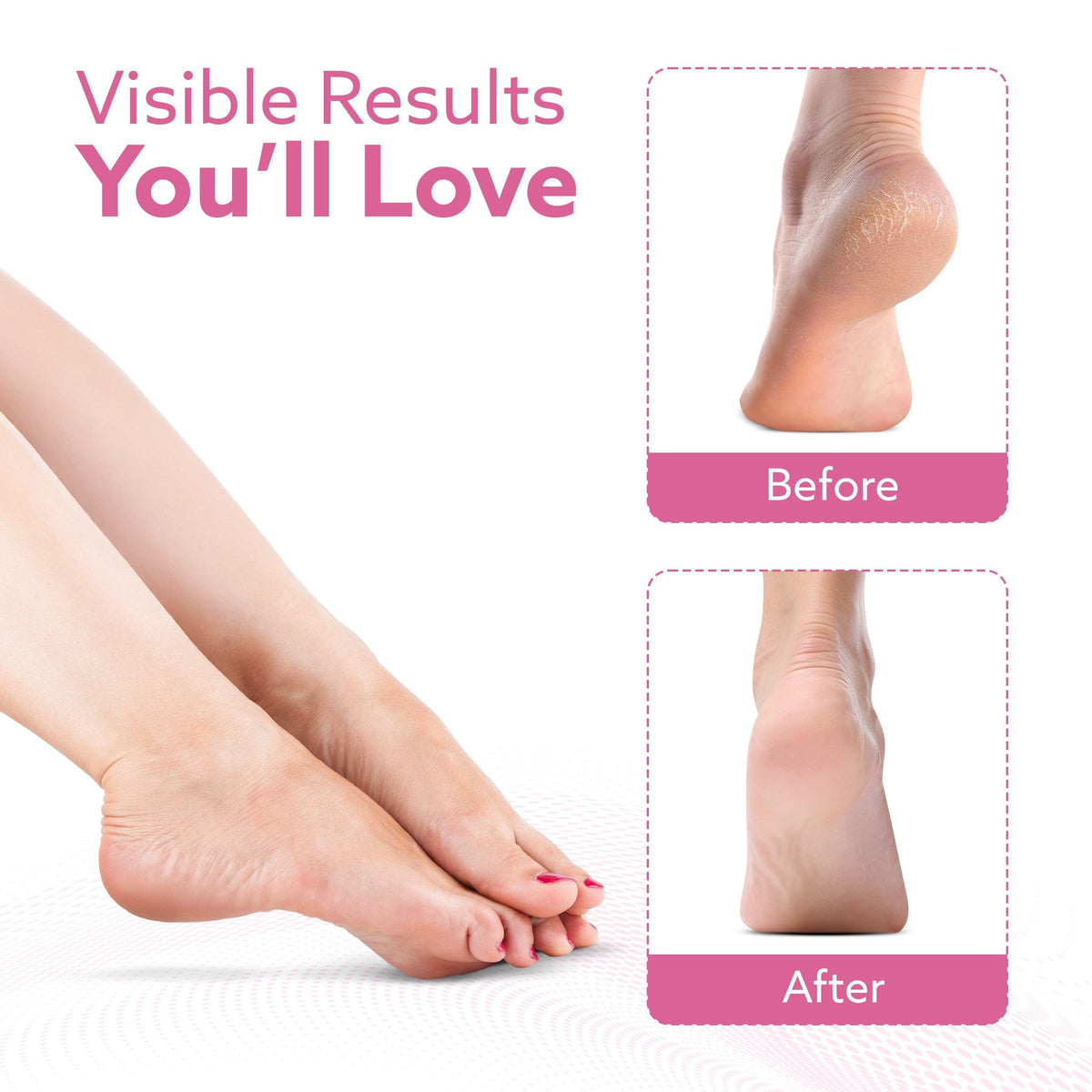 Callus Remover Replaceable Heads, 2 Pcs, Callus & Dead Skin Removal Filer, Pedicure at Home