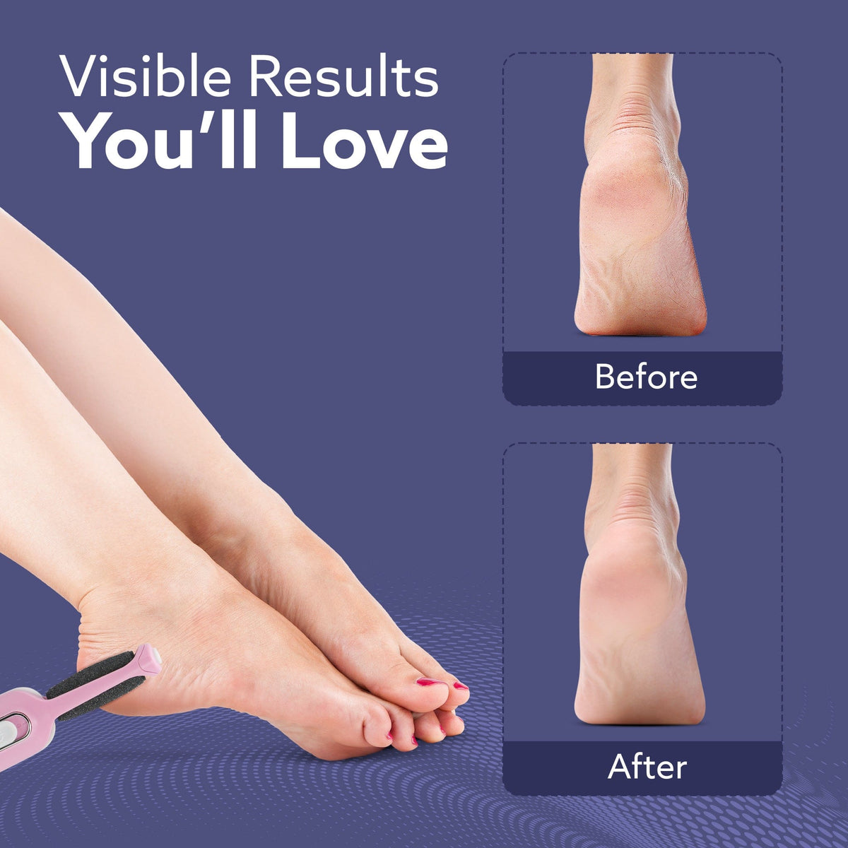 CR1717 Electric Callus Remover with 2 Replaceable Heads – Rechargeable Foot Scrubber for Dead Skin & Cracked Heels | Pedicure Machine with 120 Minutes Runtime