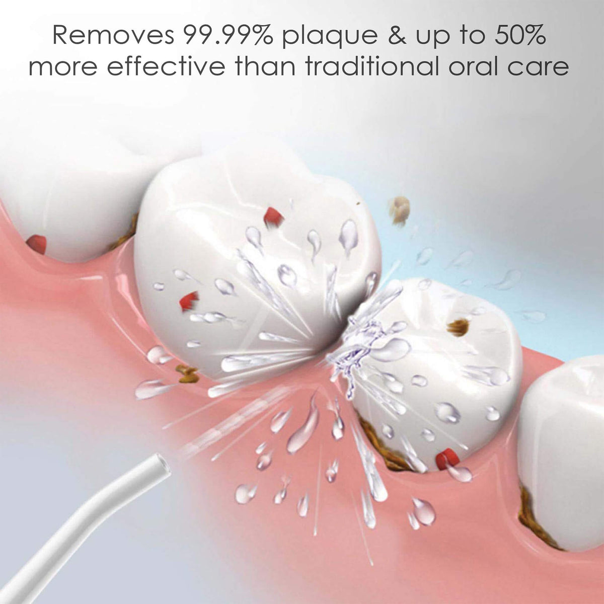 Oral Irrigator Nozzle Tip