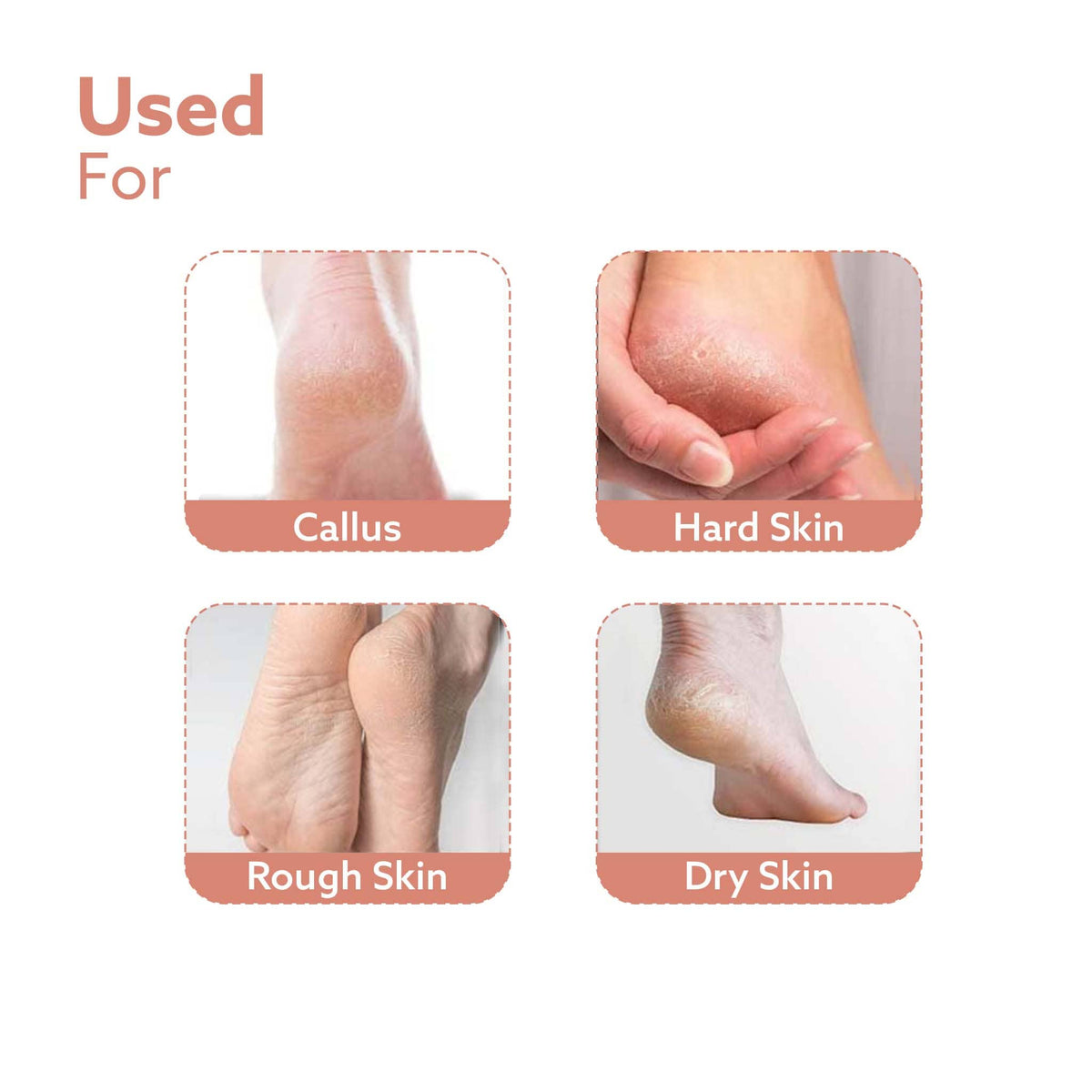 Callus Remover Replaceable Heads, 3 Pcs