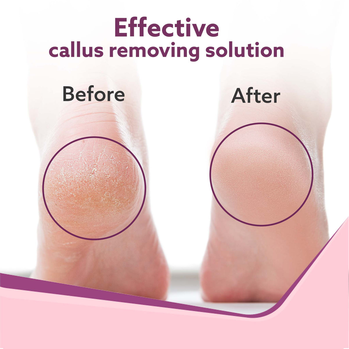 Callus Remover with 3 Interchangeable Head Rollers, Electronic Foot Scrubber For Callus & Dead Skin Removal, Pedicure Device, 2 Speed, Rechargeable Foot Care, Waterproof, CR1727, Pink