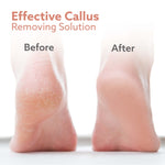 Callus Remover Replaceable Heads, 3 Pcs
