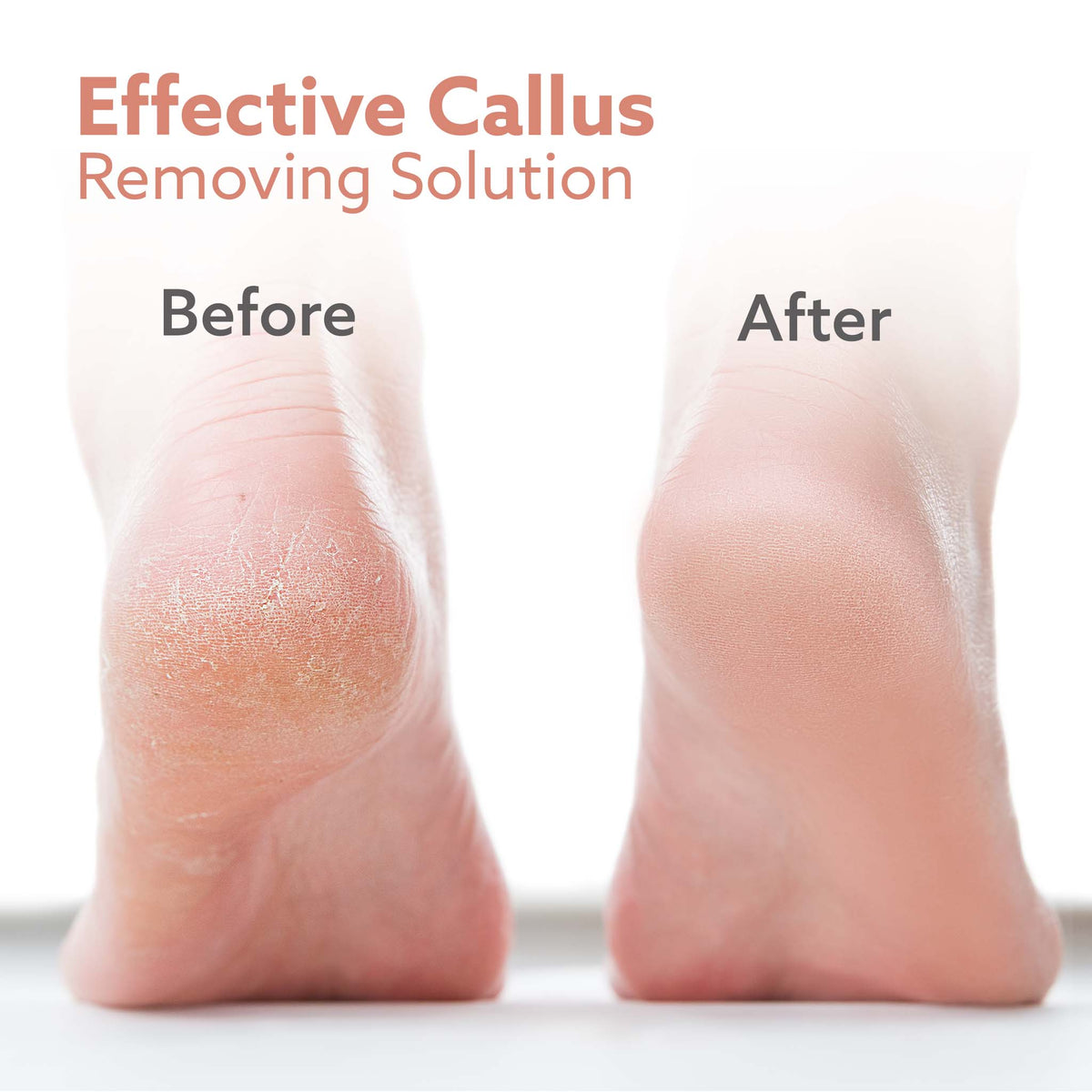 Callus Remover Replaceable Heads, 3 Pcs